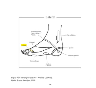 199
Figura 109 - Patologias dos Pés - Frieiras - (Lateral).
Fonte: Acervo da autora, 2008.
 