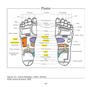 206
Figuras 112 - Outras Patologias - Artrite - (Plantar).
Fonte: Acervo da autora, 2008.
 