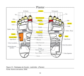 52
Figura 12 - Patologias do Ouvido - Labirintite - (Plantar).
Fonte: Acervo da autora, 2008.
 