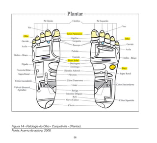 58
Figura 14 - Patologia do Olho - Conjuntivite - (Plantar).
Fonte: Acervo da autora, 2008.
 