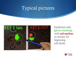 Typical pictures
Epithelial cells
(green staining),
with red nucleus
as marker for
beginning
cell death.
 