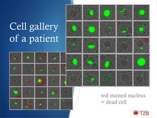 Cell gallery
of a patient
red stained nucleus
= dead cell
 