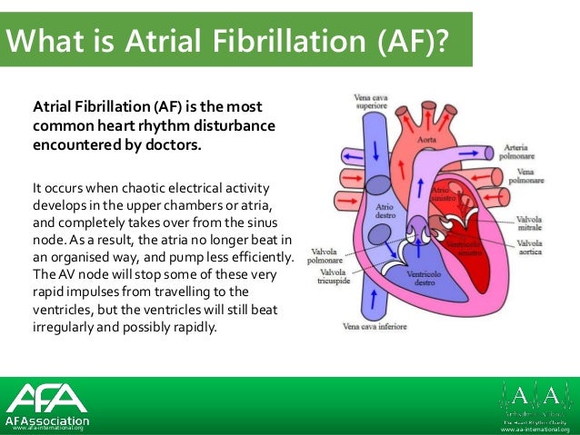 150317 What is AF? Slideshow
