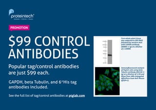 8Cardiovascular Research Focus
www.ptglab.com
$99 CONTROL
ANTIBODIES
Popular tag/control antibodies
are just $99 each.
GAPDH, beta Tubulin, and 6*His tag
antibodies included.
See the full list of tag/control antibodies at ptglab.com
PROMOTION
Corn whole-plant tissue
was subjected to SDS PAGE
followed by western blot
with GAPDH antibody
(60004-1-Ig) at a dilution
of 1:10000.
Immunofluorescent analysis
of HepG2 cells using beta-
Tubulin antibody (66240-1-
Ig) at a dilution of 1:50 and
Alexa Fluor 488-conjugated
AffiniPure Goat Anti-Mouse
IgG(H+L).
 