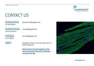 9Cardiovascular Research Focus
www.ptglab.com
CONTACT US
proteintech@ptglab.com
europe@ptglab.com
service@ptglab.com
Available 24 hours via Live Chat and 9–5
(CDT) via phone.
Proteintech Group
Proteintech Europe
Proteintech
Support
US Head Office
United Kingdom
China Office
Please visit us at www.ptglab.com for
more information about our antibodies
and technical tips.
 