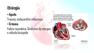 Cardiopatía valvular
