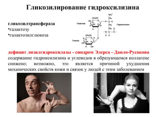 гликозилтрансфераза
•галактозу
•галактозилглюкоза
дефицит лизилгидроксилазы - синдром Элерса - Данло-Русакова
содержание гидроксилизина и углеводов в образующемся коллагене
снижено; возможно, это является причиной ухудшения
механических свойств кожи и связок у людей с этим заболеванием
Гликозилирование гидроксилизина
 
