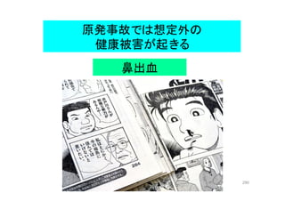 290
鼻出血
原発事故では想定外の
健康被害が起きる
 