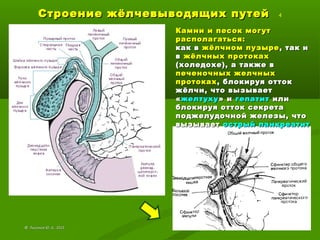 Строение жёлчевыводящих путейСтроение жёлчевыводящих путей 4
©© Лысиков Ю..А., 2015Лысиков Ю..А., 2015
Камни и песок могутКамни и песок могут
располагаться:располагаться:
как вкак в жёлчном пузырежёлчном пузыре , так и, так и
вв жёлчных протокахжёлчных протоках
(холедохе), а также в(холедохе), а также в
печеночных желчныхпеченочных желчных
протокахпротоках, блокируя отток, блокируя отток
жёлчи, что вызываетжёлчи, что вызывает
««желтухужелтуху» и» и гепатитгепатит илиили
блокируя отток секретаблокируя отток секрета
поджелудочной железы, чтоподжелудочной железы, что
вызываетвызывает острый панкреатитострый панкреатит
 