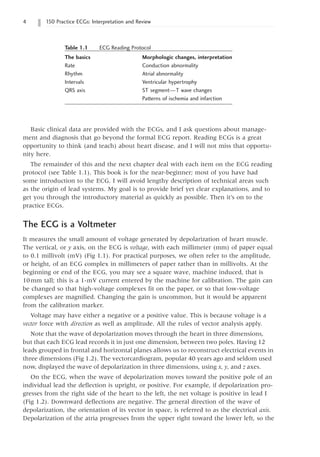 150 Practice ECGs: Interpretation and Review
Basic clinical data are provided with the ECGs, and I ask questions about manage-
ment and diagnosis that go beyond the formal ECG report. Reading ECGs is a great
opportunity to think (and teach) about heart disease, and I will not miss that opportu-
nity here.
The remainder of this and the next chapter deal with each item on the ECG reading
protocol (see Table 1.1). This book is for the near-beginner; most of you have had
some introduction to the ECG. I will avoid lengthy description of technical areas such
as the origin of lead systems. My goal is to provide brief yet clear explanations, and to
get you through the introductory material as quickly as possible. Then it’s on to the
practice ECGs.
The ECG is a Voltmeter
It measures the small amount of voltage generated by depolarization of heart muscle.
The vertical, or y axis, on the ECG is voltage, with each millimeter (mm) of paper equal
to 0.1 millivolt (mV) (Fig 1.1). For practical purposes, we often refer to the amplitude,
or height, of an ECG complex in millimeters of paper rather than in millivolts. At the
beginning or end of the ECG, you may see a square wave, machine induced, that is
10mm tall; this is a 1-mV current entered by the machine for calibration. The gain can
be changed so that high-voltage complexes fit on the paper, or so that low-voltage
complexes are magnified. Changing the gain is uncommon, but it would be apparent
from the calibration marker.
Voltage may have either a negative or a positive value. This is because voltage is a
vector force with direction as well as amplitude. All the rules of vector analysis apply.
Note that the wave of depolarization moves through the heart in three dimensions,
but that each ECG lead records it in just one dimension, between two poles. Having 12
leads grouped in frontal and horizontal planes allows us to reconstruct electrical events in
three dimensions (Fig 1.2). The vectorcardiogram, popular 40 years ago and seldom used
now, displayed the wave of depolarization in three dimensions, using x, y, and z axes.
On the ECG, when the wave of depolarization moves toward the positive pole of an
individual lead the deflection is upright, or positive. For example, if depolarization pro-
gresses from the right side of the heart to the left, the net voltage is positive in lead I
(Fig 1.2). Downward deflections are negative. The general direction of the wave of
depolarization, the orientation of its vector in space, is referred to as the electrical axis.
Depolarization of the atria progresses from the upper right toward the lower left, so the
Table 1.1   ECG Reading Protocol
The basics Morphologic changes, interpretation
Rate Conduction abnormality
Rhythm Atrial abnormality
Intervals Ventricular hypertrophy
QRS axis ST segment—T wave changes
Patterns of ischemia and infarction
 
