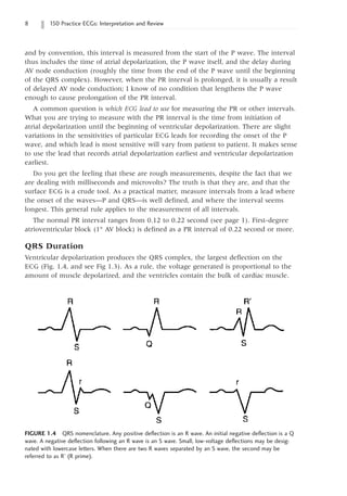 150 Practice ECGs: Interpretation and Review
and by convention, this interval is measured from the start of the P wave. The interval
thus includes the time of atrial depolarization, the P wave itself, and the delay during
AV node conduction (roughly the time from the end of the P wave until the beginning
of the QRS complex). However, when the PR interval is prolonged, it is usually a result
of delayed AV node conduction; I know of no condition that lengthens the P wave
enough to cause prolongation of the PR interval.
A common question is which ECG lead to use for measuring the PR or other intervals.
What you are trying to measure with the PR interval is the time from initiation of
atrial depolarization until the beginning of ventricular depolarization. There are slight
variations in the sensitivities of particular ECG leads for recording the onset of the P
wave, and which lead is most sensitive will vary from patient to patient. It makes sense
to use the lead that records atrial depolarization earliest and ventricular depolarization
earliest.
Do you get the feeling that these are rough measurements, despite the fact that we
are dealing with milliseconds and microvolts? The truth is that they are, and that the
surface ECG is a crude tool. As a practical matter, measure intervals from a lead where
the onset of the waves—P and QRS—is well defined, and where the interval seems
longest. This general rule applies to the measurement of all intervals.
The normal PR interval ranges from 0.12 to 0.22 second (see page 1). First-degree
atrioventricular block (1° AV block) is defined as a PR interval of 0.22 second or more.
QRS Duration
Ventricular depolarization produces the QRS complex, the largest deflection on the
ECG (Fig. 1.4, and see Fig 1.3). As a rule, the voltage generated is proportional to the
amount of muscle depolarized, and the ventricles contain the bulk of cardiac muscle.
FIGURE 1.4 QRS nomenclature. Any positive deflection is an R wave. An initial negative deflection is a Q
wave. A negative deflection following an R wave is an S wave. Small, low-voltage deflections may be desig-
nated with lowercase letters. When there are two R waves separated by an S wave, the second may be
referred to as R’ (R prime).
 