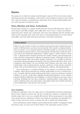 chapter 1: Baseline Data 11
Rhythm
My purpose is to help the student read through a stack of ECGs in the heart station
(and look good to the attending). I will review selected rhythms common in this setting,
but I will not attempt a comprehensive discussion of the rhythm abnormalities that
you will encounter in telemetry units.
Sinus Rhythm and Sinus Arrhythmia
Normal sinus rhythm is a regular rhythm between 60 and 100 beats/min, with a P
wave before each QRS complex and a QRS after each P wave. A faster rate defines
tachycardia and a slower rate, bradycardia. The term sinus indicates that the rhythm orig-
inates in the sinoatrial (SA) node, that there is atrial depolarization (a P wave before
each QRS), and that atrial contraction precedes ventricular contraction.
CLINICAL INSIGHT
When you are excited, or when you walk up stairs and are short winded and your
pulse is 120 beats/min, you have sinus tachycardia. This usually is a benign rhythm,
but not always. It is a normal response of healthy people to exercise. But sinus
tachycardia in a patient who is at rest and pain free the day after an MI may indi-
cate severe left ventricular dysfunction. Cardiac output = stroke volume ¥ heart
rate. A depressed left ventricle generates less stroke volume, and increasing the
rate is the first compensatory response to maintain output. Although a heart rate
90 beats/minute does not require specific treatment, it is a marker of decom­
pensation and poor prognosis in patients who have had an MI and in those with
congestive heart failure. Do not overlook other illnesses that may cause sinus
tachycardia, such as thyrotoxicosis, anemia, and fever. It may also be caused by
drugs, such as thyroid hormone, catecholamines, caffeine, and amphetamines.
Sinus bradycardia is a common finding. In the absence of conduction abnor-
malities, when all the intervals are normal, bradycardia at rest is a normal vari-
ant. It usually indicates good cardiovascular fitness, and it is common in trained
athletes. It can be a drug effect (digitalis, b-adrenergic blockers, or the calcium
channel blockers diltiazem and verapamil). A variety of illnesses can cause sinus
slowing, including the sick sinus syndrome, hypothyroidism, sleep apnea, and
other conditions that cause hypoxemia. Vasovagal attacks may include profound
sinus bradycardia, sinus pauses, and syncope.
Sinus Arrhythmia
During the respiratory cycle, the vagus nerve is intermittently activated, producing a
beat-to-beat variation in heart rate. On the 12-lead ECG (which is a relatively short
rhythm strip), this is seen as a variable RR interval. When pronounced, it may affect
your quick and easy calculation of heart rate using the technique just described. Be
aware of this, but do not worry as long as the rate is within the normal limits.
Sinus arrhythmia usually indicates good cardiovascular health. It disappears when
the heart is sick, as in the case of heart failure. The autonomic nervous system
 