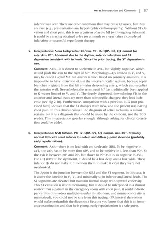 PART III: Interpretation and Comments 217
inferior wall scar. There are other conditions that may cause Q waves, but they
are rare (e.g., pre-excitation and hypertrophic cardiomyopathy). Without ST ele-
vation and chest pain, this is not a pattern of acute MI (with ongoing ischemia).
It could be a tracing obtained a day (or a month or a year) after a completed
infarction or successful reperfusion therapy.
5. Interpretation: Sinus tachycardia 120/min. PR .16, QRS .08, QT normal for
rate. Axis 70°. Abnormal due to the rhythm, anterior infarction and ST
depression consistent with ischemia. Since the prior tracing, the ST depression is
new.
Comment: Axis—it is closest to isoelectric in aVL, but slightly negative, which
would push the axis to the right of 60°. Morphology—Qs limited to V1 and V2
may be called a septal MI, but anterior is fine. Based on coronary anatomy, it is
impossible to have infarction of just the interventricular septum, because septal
branches originate from the left anterior descending artery, which also supplies
the anterior wall. Nevertheless, the term septal MI has traditionally been applied
to Q waves limited to V1 and V2. The deeply depressed, downsloping STs in the
anterior and lateral leads are more than nonspecific changes: they look isch-
emic (see Fig 2.10). Furthermore, comparison with a previous ECG (not pro-
vided here) showed that the ST changes were new, and the patient was having
chest pain. In this clinical context, the diagnosis of active ischemia is almost
certain, but it is a diagnosis that should be made by the clinician, not the ECG
reader. This interpretation goes far enough, although asking for clinical correla-
tion could be added.
6. Interpretation: NSR 80/min. PR .12, QRS .09, QT normal. Axis 80°. Probably
normal ECG with small inferior Qs noted, and diffuse J-point elevation (probably
early repolarization).
Comment: Axis—there is no lead with an isoelectric QRS. To be negative in
aVL, the axis has to be more than 60°, and to be positive in I, less than 90°. So
the axis is between 60° and 90°, but closer to 90° as it is so negative in aVL.
For a Q wave to be significant, it should be a box deep and a box wide. These
inferior Qs do not make it; I mention them to make it clear they were not
overlooked.
The J point is the junction between the QRS and the ST segment. In this case, it
is above the baseline in V2–V6, and minimally so in inferior and lateral leads. The
ST segments are elevated but maintain normal shape with upward concavity.
This ST elevation is worth mentioning, but it should be interpreted in a clinical
context. For a patient in the emergency room with chest pain, it could indicate
pericarditis (it involves multiple vascular distributions, and normal concavity is
maintained); you could not be sure from this tracing. (PR interval depression
would make pericarditis the diagnosis.) Because you know that this is an insur-
ance examination and that he is young, early repolarization is a safe guess.
 