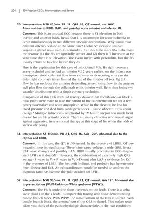 224 150 Practice ECGs: Interpretation and Review
30. Interpretation: NSR 80/min. PR .18, QRS .16, QT normal, axis 100°.
Abnormal due to RBBB, RAD, and possibly acute anterior and inferior MI.
Comment: This is an unusual ECG because there is ST elevation in both
inferior and anterior leads. Recall that it is uncommon for acute ischemia to
occur simultaneously in two different vascular distributions. Why would two
different arteries occlude at the same time? Global ST elevation instead
suggests a global cause such as pericarditis. But this looks more like ischemia to
me because (1) the STs are upwardly convex and (2) there is T inversion at the
same time there is ST elevation. The Ts can invert with pericarditis, but the STs
usually return to baseline before they do.
Here is the explanation for this case of coincidental MIs. His right coronary
artery occluded and he had an inferior MI 2 years earlier, but the infarct was
incomplete. Good collateral flow from the anterior descending artery to the
distal right coronary artery limited the size of the inferior MI (see Fig 2.8).
Now he has occluded the anterior descending artery, losing flow to the anterior
wall plus flow through the collaterals to his inferior wall. He is thus losing two
vascular distributions with a single coronary occlusion.
Comparison of this ECG with old tracings showed that the bifascicular block is
new; plans were made to take the patient to the catheterization lab for a tem-
porary pacemaker and acute angioplasty. While in the elevator, he lost his
blood pressure and died from cardiogenic shock. (Cause of death: How about
old age? Multiple infarctions complicated by LV failure are just too much heart
disease for an 85-year-old person. There are many clinicians who would argue
against aggressive, interventional therapy at this stage of life when the odds of
success are poor.)
31. Interpretation: ST 1
10/min. PR .14, QRS .16. Axis -20°. Abnormal due to the
rhythm and LBBB.
Comment: In this case, the QTc is .50 second. In the presence of LBBB, QT pro-
longation loses its significance. There is increased voltage, a wide QRS, lateral
ST-T wave changes and possibly LAA. LBBB usually precludes an ECG diagno-
sis of LVH (as it does MI). However, the combination of extremely high QRS
voltage (S wave in V2 + R wave in V6  45mm) plus LAA is evidence for LVH
in the presence of LBBB. She has both findings, and probably has hypertensive
heart disease and LVH. An echocardiogram would be needed to confirm the
diagnosis (and has become the gold standard for LVH).
32. Interpretation: NSR 90/min. PR .1
1, QRS .13, QT normal. Axis 15°. Abnormal due
to pre-excitation (Wolff-Parkinson-White syndrome [WPW]).
Comment: The PR is borderline short (depends on the lead). There is a delta
wave (lead I or the V leads). Compare this tracing with those demonstrating
bundle branch block. With WPW, the initial portion of the QRS is slurred. With
bundle branch block, the terminal part of the QRS is slurred. This makes sense
when you think of the pathophysiologic characteristics of the two conditions
 