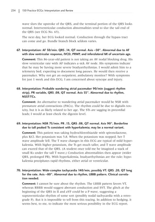 234 150 Practice ECGs: Interpretation and Review
wave slurs the upstroke of the QRS, and the terminal portion of the QRS looks
normal. Interventricular conduction abnormalities tend to slur the tail end of
the QRS (see ECG No. 65).
The next day, her ECG looked normal. Conduction through the bypass tract
can come and go. Bundle branch block seldom varies.
67. Interpretation: AF 50/min. QRS .14, QT normal. Axis -50°. Abnormal due to AF
with slow ventricular response, IVCD, PRWP, and inferolateral MI of uncertain age.
Comment: This 86-year-old patient is not taking an AV nodal blocking drug. His
slow ventricular rate with AF indicates a sick AV node. His symptoms indicate
that he may be having more severe bradyarrhythmias. I would admit him to a
telemetry bed, expecting to document long pauses. He would then receive a
pacemaker. Why not get an outpatient, ambulatory monitor? With symptoms
for just 1 week and this ECG, I am concerned about syncope and injury.
68. Interpretation: Probable wandering atrial pacemaker 90/min (suggest rhythm
strip). PR variable, QRS .08, QT normal. Axis 55°. Abnormal due to rhythm,
NSST-TCs.
Comment: An alternative to wandering atrial pacemaker would be NSR with
premature atrial contractions (PACs). The rhythm could be due to digitalis tox-
icity, but it is as likely related to her age. The STs are sagging in precordial
leads; I would at least check the digoxin level.
69. Interpretation: NSR 75/min. PR .13, QRS .08, QT normal. Axis 90°. Borderline
due to tall peaked Ts consistent with hyperkalemia; may be a normal variant.
Comment: This patient was taking hydrochlorothiazide with spironolactone,
plus KCl. Her potassium was 5.8. When the potassium was stopped, her T
wave amplitude fell. The T wave changes in this ECG are typical of mild hyper-
kalemia. With higher potassium, the Ts get much taller, and T wave amplitude
can exceed that of the QRS. (A student once told me he imagined a stack of
small Ks under the tall T wave.) Conduction abnormalities then appear (wider
QRS, prolonged PR). With hyperkalemia, bradyarrhythmias are the rule; hypo-
kalemia precipitates rapid rhythms, either atrial or ventricular.
70. Interpretation: Wide-complex tachycardia 140/min, possibly VT. QRS .20, QT long
for the rate. Axis -80°. Abnormal due to rhythm, LBBB pattern. Clinical correla-
tion needed.
Comment: I cannot be sure about the rhythm. The LBBB pattern favors VT,
whereas RBBB would suggest aberrant conduction and SVT. The glitch at the
beginning of the QRS in II and aVF could be a P wave, suggesting a
supraventricular rhythm of some sort (possibly nodal tachycardia with a retro-
grade P). But it is impossible to tell from this tracing. In addition to hedging, it
seems best, to me, to indicate the most serious possibility in the ECG report.
 