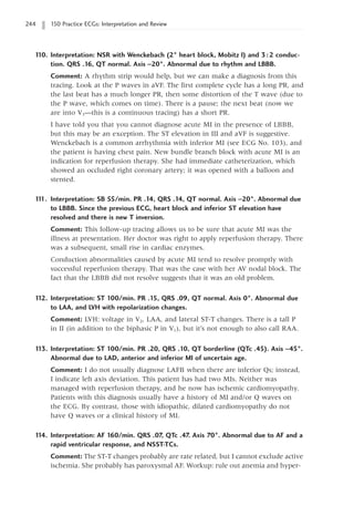 244 150 Practice ECGs: Interpretation and Review
1
10. Interpretation: NSR with Wenckebach (2° heart block, Mobitz I) and 3:2 conduc-
tion. QRS .16, QT normal. Axis -20°. Abnormal due to rhythm and LBBB.
Comment: A rhythm strip would help, but we can make a diagnosis from this
tracing. Look at the P waves in aVF. The first complete cycle has a long PR, and
the last beat has a much longer PR, then some distortion of the T wave (due to
the P wave, which comes on time). There is a pause; the next beat (now we
are into V3—this is a continuous tracing) has a short PR.
I have told you that you cannot diagnose acute MI in the presence of LBBB,
but this may be an exception. The ST elevation in III and aVF is suggestive.
Wenckebach is a common arrhythmia with inferior MI (see ECG No. 103), and
the patient is having chest pain. New bundle branch block with acute MI is an
indication for reperfusion therapy. She had immediate catheterization, which
showed an occluded right coronary artery; it was opened with a balloon and
stented.
1
1
1. Interpretation: SB 55/min. PR .14, QRS .14, QT normal. Axis -20°. Abnormal due
to LBBB. Since the previous ECG, heart block and inferior ST elevation have
resolved and there is new T inversion.
Comment: This follow-up tracing allows us to be sure that acute MI was the
illness at presentation. Her doctor was right to apply reperfusion therapy. There
was a subsequent, small rise in cardiac enzymes.
Conduction abnormalities caused by acute MI tend to resolve promptly with
successful reperfusion therapy. That was the case with her AV nodal block. The
fact that the LBBB did not resolve suggests that it was an old problem.
1
12. Interpretation: ST 100/min. PR .15, QRS .09, QT normal. Axis 0°. Abnormal due
to LAA, and LVH with repolarization changes.
Comment: LVH: voltage in V2, LAA, and lateral ST-T changes. There is a tall P
in II (in addition to the biphasic P in V1), but it’s not enough to also call RAA.
1
13. Interpretation: ST 100/min. PR .20, QRS .10, QT borderline (QTc .45). Axis -45°.
Abnormal due to LAD, anterior and inferior MI of uncertain age.
Comment: I do not usually diagnose LAFB when there are inferior Qs; instead,
I indicate left axis deviation. This patient has had two MIs. Neither was
managed with reperfusion therapy, and he now has ischemic cardiomyopathy.
Patients with this diagnosis usually have a history of MI and/or Q waves on
the ECG. By contrast, those with idiopathic, dilated cardiomyopathy do not
have Q waves or a clinical history of MI.
1
14. Interpretation: AF 160/min. QRS .07, QTc .47. Axis 70°. Abnormal due to AF and a
rapid ventricular response, and NSST-TCs.
Comment: The ST-T changes probably are rate related, but I cannot exclude active
ischemia. She probably has paroxysmal AF. Workup: rule out anemia and hyper-
 