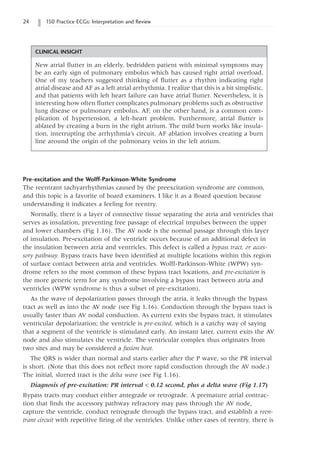 24 150 Practice ECGs: Interpretation and Review
Pre-excitation and the Wolff-Parkinson-White Syndrome
The reentrant tachyarrhythmias caused by the preexcitation syndrome are common,
and this topic is a favorite of board examiners. I like it as a Board question because
understanding it indicates a feeling for reentry.
Normally, there is a layer of connective tissue separating the atria and ventricles that
serves as insulation, preventing free passage of electrical impulses between the upper
and lower chambers (Fig 1.16). The AV node is the normal passage through this layer
of insulation. Pre-excitation of the ventricle occurs because of an additional defect in
the insulation between atria and ventricles. This defect is called a bypass tract, or acces-
sory pathway. Bypass tracts have been identified at multiple locations within this region
of surface contact between atria and ventricles. Wolff-Parkinson-White (WPW) syn-
drome refers to the most common of these bypass tract locations, and pre-excitation is
the more generic term for any syndrome involving a bypass tract between atria and
ventricles (WPW syndrome is thus a subset of pre-excitation).
As the wave of depolarization passes through the atria, it leaks through the bypass
tract as well as into the AV node (see Fig 1.16). Conduction through the bypass tract is
usually faster than AV nodal conduction. As current exits the bypass tract, it stimulates
ventricular depolarization; the ventricle is pre-excited, which is a catchy way of saying
that a segment of the ventricle is stimulated early. An instant later, current exits the AV
node and also stimulates the ventricle. The ventricular complex thus originates from
two sites and may be considered a fusion beat.
The QRS is wider than normal and starts earlier after the P wave, so the PR interval
is short. (Note that this does not reflect more rapid conduction through the AV node.)
The initial, slurred tract is the delta wave (see Fig 1.16).
Diagnosis of pre-excitation: PR interval  0.12 second, plus a delta wave (Fig 1.17)
Bypass tracts may conduct either antegrade or retrograde. A premature atrial contrac-
tion that finds the accessory pathway refractory may pass through the AV node,
capture the ventricle, conduct retrograde through the bypass tract, and establish a reen-
trant circuit with repetitive firing of the ventricles. Unlike other cases of reentry, there is
CLINICAL INSIGHT
New atrial flutter in an elderly, bedridden patient with minimal symptoms may
be an early sign of pulmonary embolus which has caused right atrial overload.
One of my teachers suggested thinking of flutter as a rhythm indicating right
atrial disease and AF as a left atrial arrhythmia. I realize that this is a bit simplistic,
and that patients with left heart failure can have atrial flutter. Nevertheless, it is
interesting how often flutter complicates pulmonary problems such as obstructive
lung disease or pulmonary embolus. AF, on the other hand, is a common com-
plication of hypertension, a left-heart problem. Furthermore, atrial flutter is
ablated by creating a burn in the right atrium. The mild burn works like insula-
tion, interrupting the arrhythmia’s circuit. AF ablation involves creating a burn
line around the origin of the pulmonary veins in the left atrium.
 