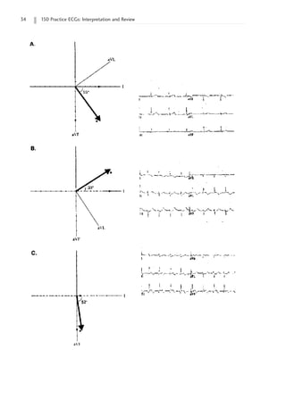 34 150 Practice ECGs: Interpretation and Review
 