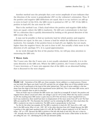 chapter 1: Baseline Data 35
FIGURE 1.22 Calculation of the QRS axis: three examples. Vector addition is a simple process. Choose
any two leads (the figure uses leads I and aVF) and plot the net voltage. Move one of these plotted vectors
so that its tail is positioned at the head of the other (dotted line). The sum of vector addition is the line
drawn from the origin of the head of the repositioned vector (bold line). This is the mean QRS vector, and it
is what the computer does to plot its direction.
There are faster ways to estimate the QRS vector axis. Look first at example C. In lead I, the positive and
negative forces almost cancel each other; net voltage is just 0.1 mV (1 mm). When this tiny vector is moved
to aVF, the resulting mean ORS vector is quite close to aVF. If the net forces in lead I equaled 0mV (i.e.,
lead I was isoelectric), there would have been no displacement of the mean vector from aVF at all. The final
QRS axis would be 90°. This illustrates the method I use for estimating the QRS axis: find a lead where the
QRS is isoelectric (or close to isoelectric). The QRS vector is perpendicular to that lead.
Try this for the other two examples. A: The QRS is isoelectric in lead aVL; 90° from aVL is +60°, and
that is the QRS vector. Why is it not -120°, 90° in the other direction from aVL? Simply because the QRS
is positive in the right lower quadrant leads (I, II, aVF). B: The QRS is almost isoelectric in II; 90° from II is
either -30° or +150°. Because the QRS is positive in the left side leads (I and aVL), the axis is close to
-30°. Actually, the net forces in II are slightly negative, which pushes the vector a little farther to the left. I
am calling the axis -35°, identifying this as left axis deviation (LAD).
Another method uses the principle that a net vector amplitude of zero indicates that
the direction of the vector is perpendicular (90°) to the voltmeter’s orientation. Thus, if
the positive and negative QRS deflections are equal, that is to say isoelectric (or add up
to zero) in lead I of the ECG, the QRS vector is pointed at +90° or -90°. If the QRS is
positive in lead aVF, the axis must be +90°.
That is the method I use. I find a lead where the positive and negative QRS deflec-
tions are equal—where the QRS is isoelectric. The QRS axis is perpendicular to that lead;
90° in a direction that is quickly determined by looking at the general direction of the
QRS vector (Fig 1.22).
It may not be possible to find an isoelectric lead for which positive and negative
deflections are equal. In this case, I choose a lead for which the deflection is close to
isoelectric. For example, if the positive forces in lead aVL are slightly, but not much,
higher than the negative forces, the axis is close to 60°, but actually a little more in the
direction of aVL (perhaps 55°). It is a good approximation.
As we work through the first of the practice ECGs, we will pay close attention to
measuring the QRS axis.
T Wave Axis
The T wave axis, like the P wave axis, is not usually calculated. Generally, it is in the
same direction as the QRS axis. Where the QRS is positive, the T wave is also positive.
T wave inversion—a T wave axis opposite that of the QRS—in an abnormal finding
that is discussed in the next chapter.
▼
 