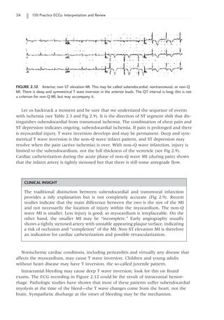 54 150 Practice ECGs: Interpretation and Review
FIGURE 2.12 Anterior, non-ST elevation MI. This may be called subendocardial, nontransmural, or non-Q
MI. There is deep and symmetrical T wave inversion in the anterior leads. The QT interval is long; this is not
a criterion for non-Q MI, but may accompany it.
CLINICAL INSIGHT
The traditional distinction between subendocardial and transmural infarction
provides a tidy explanation but is not completely accurate (Fig 2.9). Recent
studies indicate that the main difference between the two is the size of the MI
and not necessarily the location of injury within the myocardium. The non-Q
wave MI is smaller. Less injury is good, as myocardium is irreplaceable. On the
other hand, the smaller MI may be “incomplete.” Early angiography usually
shows a tightly stenosed artery with unstable appearing plaque surface, indicating
a risk of occlusion and “completion” of the MI. Non-ST elevation MI is therefore
an indication for cardiac catheterization and possible revascularization.
Let us backtrack a moment and be sure that we understand the sequence of events
with ischemia (see Table 2.3 and Fig 2.9). It is the direction of ST segment shift that dis-
tinguishes subendocardial from transmural ischemia. The combination of chest pain and
ST depression indicates ongoing, subendocardial ischemia. If pain is prolonged and there
is myocardial injury, T wave inversion develops and may be permanent. Deep and sym-
metrical T wave inversion is the non–Q wave infarct pattern, and ST depression may
resolve when the pain (active ischemia) is over. With non–Q wave infarction, injury is
limited to the subendocardium, not the full thickness of the ventricle (see Fig 2.9).
Cardiac catheterization during the acute phase of non–Q wave MI (during pain) shows
that the infarct artery is tightly stenosed but that there is still some antegrade flow.
Nonischemic cardiac conditions, including pericarditis and virtually any disease that
affects the myocardium, may cause T wave inversion. Children and young adults
without heart disease may have T inversion, the so-called juvenile pattern.
Intracranial bleeding may cause deep T wave inversion; look for this on Board
exams. The ECG recording in Figure 2.12 could be the result of intracranial hemor-
rhage. Pathologic studies have shown that most of these patients suffer subendocardial
myolysis at the time of the bleed—the T wave changes come from the heart, not the
brain. Sympathetic discharge at the onset of bleeding may be the mechanism.
 