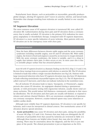 chapter 2: Morphologic Changes in P, QRS, ST, and T 55
PATHOPHYSIOLOGY
Note the basic differences between chronic stable angina and the acute coronary
syndromes including unstable angina, non-ST and ST elevation MI. With stable
angina, the lesion is fixed and angina is caused by an increase in oxygen demand.
With the acute coronary syndromes, the lesion is variable, and it is a drop in
supply that initiates chest pain. It often occurs at rest. In most cases this is due
to unstable plaque surface that has attracted platelets.
Nonischemic heart disease, such as pericarditis or myocarditis, generally produces
global changes, altering ST segments and T waves in anterior, inferior, and lateral leads.
Remember that changes resulting from ischemia are usually limited to one vascular
region.
ST Segment Elevation
The most common cause of ST segment elevation is transmural MI, now called ST-
elevation MI. Catheterization during chest pain and ST elevation shows a coronary
artery that is totally occluded. ST elevation is the primary ECG indication for emer-
gency angioplasty or thrombolytic therapy. Compared with ST segment depression,
ST elevation is a more specific indication of acute ischemia. Most patients with new
ST elevation are in the emergency room with chest pain.
Acute MI with ST segment elevation is a dramatic finding on the ECG (Figs 2.13 and 2.14).
Review these tracings from seven patients with inferior or anterior MI. The ST elevation
is limited to leads that reflect a single vascular distribution (see Fig 2.8). Patients with
large transmural infarction who have ST segment elevation may also have ST depression
in leads reflecting nonischemic myocardial regions (see Fig 2.13). The ST depression is
called reciprocal ST depression, and it does not indicate ischemia in the noninfarct zone.
Not all ischemic ST elevation leads to injury. Vasospastic, or Prinzmetal’s, angina
pectoris also causes ST elevation. An angiogram obtained during a spontaneous
episode, or with provocative testing with ergonovine infusion, usually shows total cor-
onary occlusion. This would induce full thickness—transmural—ischemia in that vascu-
lar distribution. The ST elevation and chest pain are usually self-limited, or respond to
nitrates and calcium channel blockers. MI is an uncommon complication of spontane-
ous coronary vasospasm. However, cocaine-induced spasm may cause infarction or
sudden cardiac death.
Although more reliable than ST segment depression, ST elevation is not specific for
ischemia, and it must be interpreted in clinical context. Two nonischemic causes of ST
elevation deserve special attention.
1. Acute pericarditis may cause ST elevation and chest pain, raising the possibility
of acute MI (Figs 2.15 and 2.16). Features that may help you distinguish the ST
elevation of pericarditis from that caused by ischemia are reviewed in Table 2.4.
Although these features are helpful when found, they may also be subtle or
missing. There may be uncertainty about the diagnosis, and the ECG is just one
piece of the puzzle. The clinical presentation is just as important as the ECG.
 