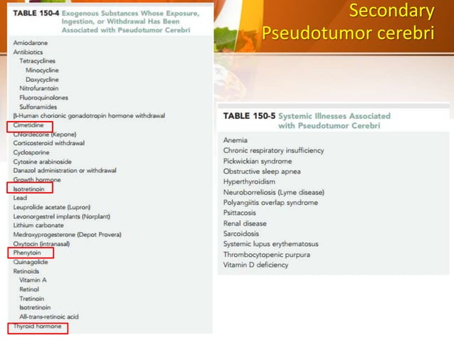 150 Pseudotumor cerebri | PPT