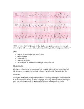 ECG104 : điện tim đồ ghi từ một người đàn ông 45t, ông ta nhập viện vào đơn vị chăm sóc mạch
vành với một cái nhồi máu cơ tim và ông ta đã hồi phục tốt. Đây là rối loạn nhịp gì và bạn sẽ làm gì ?
Trả lời
- Nhịp với các phức bộ giãn rộng tần số 90ck/p
- Không có sóng p
- Trục hướng trái
- Thời gian QRS 160ms
- Tất cả các phức bộ QRS đạo trình trước ngực hướng xuống dưới
Diễn giải lâm sàng
Nếu nhịp tim ở đây nhanh sẽ có một chút khó khăn trong việc nhận ra đây như là một nhịp nhanh
thất và nhịp này thường được gọi là ‘ nhanh thất chậm’. Tuy nhiên nó là nhịp tự thất tăng tốc.
Bạn làm gì ?
Nhịp này khá phổ biến trên những bệnh nhân nhồi máu cơ tim cấp và không phổ biến trên điện tâm
đồ ghi được người bình thường. Nó không bao giờ gây ra vấn đề gì và điều quan trọng là không bao
giờ cố gắng tìm cách điều trị nó : ức chế nhịp thoát có thể dẫn đến nhịp chậm nguy hiểm.
 