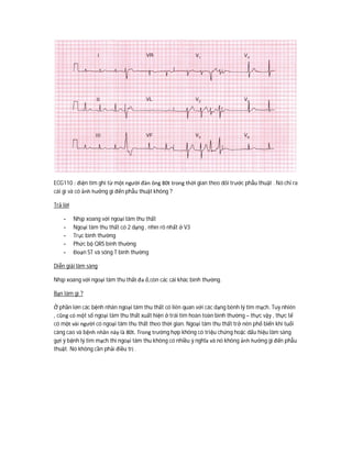 ECG110 : điện tim ghi từ một người đàn ông 80t trong thời gian theo dõi trước phẫu thuật . Nó chỉ ra
cái gì và có ảnh hưởng gì đến phẫu thuật không ?
Trả lời
- Nhịp xoang với ngoại tâm thu thất
- Ngoại tâm thu thất có 2 dạng , nhìn rõ nhất ở V3
- Trục bình thường
- Phức bộ QRS bình thường
- Đoạn ST và sóng T bình thường
Diễn giải lâm sàng
Nhịp xoang với ngoại tâm thu thất đa ổ,còn các cái khác bình thường.
Bạn làm gì ?
Ở phần lớn các bệnh nhân ngoại tâm thu thất có liên quan với các dạng bênh lý tim mạch. Tuy nhiên
, cũng có một số ngoại tâm thu thất xuất hiện ở trái tim hoàn toàn bình thường – thực vậy , thực tế
có một vài người có ngoại tâm thu thất theo thời gian. Ngoại tâm thu thất trở nên phổ biến khi tuổi
càng cao và bệnh nhân này là 80t. Trong trường hợp không có triệu chứng hoặc dấu hiệu lâm sàng
gợi ý bệnh lý tim mạch thì ngoại tâm thu không có nhiều ý nghĩa và nó không ảnh hưởng gì đến phẫu
thuật. Nó không cần phải điều trị .
 