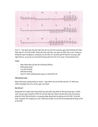 ECG111 : một người đàn ông 50t nhập viện cấp cứu với tình trạng đau ngực,ông ta không cảm nhận
thấy nhịp tim của mình nhanh. Ông ta đã từng xuất hiện đau ngực do thiếu máu cơ tim, nhưng nó
không liên quan với gắng sức. không lâu sau khi điện tim này được ghi thì nhịp tim của ông ta đột
ngột chậm lại và sau đó nó trở lại bình thường. Điện tim trên chỉ ra cái gì ? và bạn phải làm gì ?
Trả lời
- Nhịp nhanh phức bộ hẹp tần số khoảng 200ck/p
- Không thấy sóng P
- Trục bình thường
- QRS bình thường
- Đoạn ST chênh xuống dạng đi ngang ,rõ ràng nhất ở V4
Diễn giải lâm sàng
Nhịp nhanh phức bộ hẹp không có sóng P – nhịp nhanh vào lại nhĩ thất ( bộ nối ). ST thiếu máu
chênh xuống giải thích cho cái đau ngực của ông ta.
Bạn làm gì ?
Không phải tất cả bệnh nhân nhịp nhanh kịch phát đều than phiền về hồi hộp trống ngực, ở bệnh
nhân này đau ngực tái phát có thể là do rối loạn nhịp này. Ông ta cần phải được dạy các phương
pháp kích thích thần kinh phế vị, nhưng liệu pháp dùng thuốc dự phòng sẽ là cần thiết : beta bloc
hoặc verapamil nên cố gắng cho trước. Một thăm dò điện sinh lý để cắt bỏ đường bất thường có thể
là cần thiết.
 