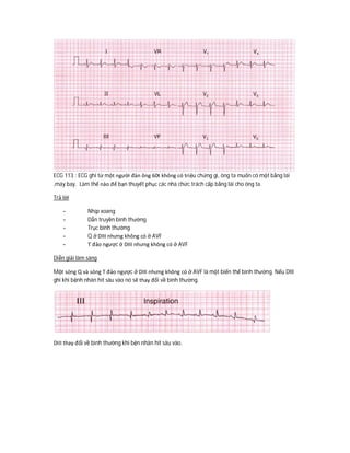 ECG 113 : ECG ghi từ một người đàn ông 60t không có triệu chứng gì, ông ta muốn có một bằng lái
,máy bay. Làm thế nào để bạn thuyết phục các nhà chức trách cấp bằng lái cho ông ta.
Trả lời
- Nhịp xoang
- Dẫn truyền bình thường
- Trục bình thường
- Q ở DIII nhưng không có ở AVF
- T đảo ngược ở DIII nhưng không có ở AVF
Diễn giải lâm sàng
Một sóng Q và sóng T đảo ngược ở DIII nhưng không có ở AVF là một biến thể bình thường. Nếu DIII
ghi khi bệnh nhân hít sâu vào nó sẽ thay đổi về bình thường.
DIII thay đổi về bình thường khi bện nhân hít sâu vào.
 
