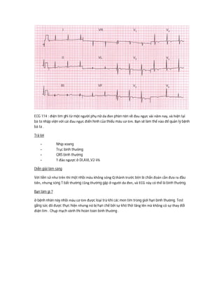ECG 114 : điện tim ghi từ một người phụ nữ da đen phàn nàn về đau ngực vài năm nay, và hiện tại
bà ta nhập viện với cái đau ngực điển hình của thiếu máu cơ tim. Bạn sẽ làm thế nào để quản lý bệnh
bà ta .
Trả lời
- Nhịp xoang
- Trục bình thường
- QRS bình thường
- T đảo ngược ở DI,AVL,V2-V6
Diễn giải lâm sàng
Với tiền sử như trên thì một nhồi máu không sóng Q thành trước bên là chẩn đoán cần đưa ra đầu
tiên, nhưng sóng T bất thường cũng thường gặp ở người da đen, và ECG này có thể là bình thường.
Bạn làm gì ?
ở bệnh nhân này nhồi máu cơ tim được loại trừ khi các men tim trong giới hạn bình thường. Test
gắng sức đã được thực hiện nhưng nó bị hạn chế bởi sự khó thở tăng lên mà không có sự thay đổi
điện tim . Chụp mạch vành thì hoàn toàn bình thường .
 