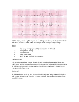 ECG116 : một người đàn ông 70t, ông ta có cái đau thắt ngực vài năm nay, bắt đầu phàn nàn về xuất
hiện những cơn chóng mặt. Đây là điện tim của ông ta. Nó chỉ ra cái gì và bạn phải làm gì ?
Trả lời
- Nhịp xoang, thường xuyên xuất hiện các ngoại tâm thu thất đa ổ
- Khoảng PR bình thường
- Trục bình thường
- Sóng Q ở DII,DIII,AVF
- Sóng T dẹt hoặc đảo ngược ở DII,DIII,V5-V6
Diễn giải lâm sàng
ECG chỉ ra một cái nhồi máu cũ thành sau dưới mà nó là nguyên nhân giải thích cho cái đau thắt
ngực của ông ta. Ngoại tâm thu thất bản thân nó không quan trọng, nhưng ở bệnh nhân phàn nàn về
sự xuất hiện những cơn chóng mặt thì ngoại tâm thu thất thường xuyên và đa ổ có thể là nguyên
nhân gây suy giảm huyết động.
Bạn làm gì ?
Sẽ có ích khi ghi điện tim đồ lưu động để xem nếu bệnh nhân có xuất hiện những đoạn nhịp nhanh
thất thì ngoại tâm thu này cần được điều trị. Sotalol sẽ là thuốc được cố gắng sử đụng đầu tiên, và
sau đó là Amidaron .
 
