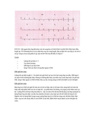 ECG118 : một người đàn ông 60t phàn nàn về sưng đau cổ chân khám và phát hiên thấy mạch đều,
huyết áp 115/70mmhg,tim to và có dấu hiêụ suy tim sung huyết. Đây là điện tim của ông ta, nó chỉ ra
cái gì ? ông ta chưa từng điều trị gì, bạn sẽ làm thế nào để điều trị ông ta ?
Trả lời
- Cuồng nhĩ với bloc 4 :1
- Trục bình thường
- QRS hẹp ở các đạo trình
- Sóng T khó xác định nhưng đảo ngược ở AVL
Diễn giải lâm sàng
Cuồng nhĩ với dẫn truyền 4 :1 ổn định nên giải thích tại sao trên lâm sàng nhịp tim đều .QRS hẹp ở
các đạo trình là không đặc hiệu. Không có những dấu hiệu của nhồi máu trước đây hoặc của phì đại
thất. Sóng T đảo ngược có thể là thiếu máu cục bộ ,nhưng cũng có thể là do bệnh cơ tim thể giãn.
Diễn giải lâm sàng
Nếu ông ta có thất trái giãn thì siêu âm sẽ cho ta thấy, nếu có rối loạn chức năng thất trái toàn bộ
hoặc nếu một phần thất trái còn co bóp tốt , các phần khác thì không, nó sẽ gợi ý một thiếu máu cục
bộ . Cuồng nhĩ là rối loạn nhịp khó điều trị : nếu tim đã to thì rất khó để hồi phục lại nhịp xoang kể cả
dùng thuốc hay sốc điện, và nếu mức độ bloc ổn định ( như hiện tại ) thì tốt nhất nên duy trì nó.
Digoxin nên sử dụng thận trọng trong trường hợp này nó có thể làm tăng mức độ bloc hoặc nhịp
chậm. Suy tim nên được điều trị với ƯCMC và lợi tiểu. Bệnh nhân này bị bệnh cơ tim thể giãn do
rượu .
 