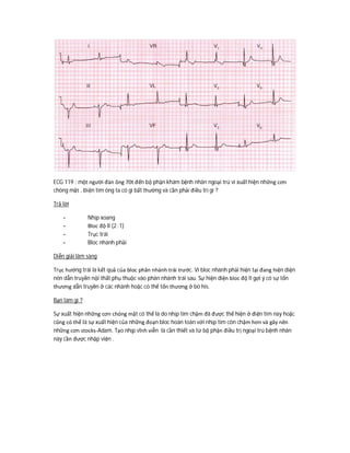ECG 119 : một người đàn ông 70t đến bộ phận khám bệnh nhân ngoại trú vì xuất hiện những cơn
chóng mặt . Điện tim ông ta có gì bất thường và cần phải điều trị gì ?
Trả lời
- Nhịp xoang
- Bloc độ II (2 :1)
- Trục trái
- Bloc nhánh phải
Diễn giải lâm sàng
Trục hướng trái là kết quả của bloc phân nhánh trái trước. Vì bloc nhánh phải hiện tại đang hiện diện
nên dẫn truyền nội thất phụ thuộc vào phân nhánh trái sau. Sự hiện diện bloc độ II gợi ý có sự tổn
thương dẫn truyền ở các nhánh hoặc có thể tổn thương ở bó his.
Bạn làm gì ?
Sự xuất hiện những cơn chóng mặt có thể là do nhịp tim chậm đã được thể hiện ở điện tim này hoặc
cũng có thể là sự xuất hiện của những đoạn bloc hoàn toàn với nhịp tim còn chậm hơn và gây nên
những cơn stocks-Adam. Tạo nhịp vĩnh viễn là cần thiết và từ bộ phận điều trị ngoại trú bệnh nhân
này cần được nhập viện .
 