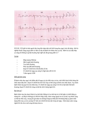 ECG120 : ECG ghi từ một người đàn ông 30t nhập viện với tình trạng đau ngực mức độ nặng . Anh ta
nghiện thuốc nặng và gia đình có tiền sử xấu về bệnh tim thiếu máu cục bộ . Kiểm tra các dấu hiệu
cơ năng thì không có gì bất thường. Bạn nghĩ vấn đề gì đang diễn ra ?
Trả lời
- Nhịp xoang 100ck/p
- Dẫn truyền bình thường
- Trục bình thường
- Phức bộ QRS bình thường
- Đoạn ST chênh lên ở DI,DII,AVL,V3-V6
- ST chênh lên ngay sau sóng S ( high take off) V3-V5
- T đảo ngược ở DIII
Diễn giải lâm sàng
Ở bệnh nhân đau ngực với nhiều yếu tố nguy cơ của nhồi máu cơ tim, một nhồi máu là khả năng cần
chẩn đoán đầu tiên . Đoạn ST chênh lên trên ECG này có thể củng cố thêm cho chẩn đoán. Tuy nhiên
bệnh nhân này quá trẻ cho nhồi máu. ST chênh lên ngay sau sóng S V3-V5 là một biến thể bình
thường. Đoạn ST chênh lên cũng có thể do viêm màng ngoài tim.
Bạn làm gì ?
Bệnh nhân này cần được khám ở tư thế nằm thẳng vì ở tư thế này ta có thể nghe rõ nhất tiếng cọ
màng tim – và đấy là những gì có thể tìm thấy ở đây. Viêm màng ngoài tim là có thể, tuy nhiên cũng
có thể do nhồi máu, nhưng khi ghi điện tim đồ lặp đi lặp lại nhiều lần thì không thấy sự phát triển
dạng nhồi máu cơ tim và đoạn ST vẫn còn chênh lên kéo dài trong vài ngày . Chẩn đoán viêm màng
ngoài tim do virus cuối cùng đã được đưa ra.
 