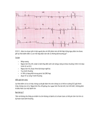 ECG11 : điện tim được ghi ở một người phụ nữ 40t phàn nàn về hồi hộp trống ngực,điện tim đươc
ghi tại thời điểm diễn ra cơn hồi hộp.Điện tâm đồ có những bất thường gì ?
Trả lời
- Nhịp xoang
- Ngoai tâm thu nhĩ ,nhận ra bởi nhịp đến sớm với sóng p rộng và khác thường ( nhìn rõ ở đạo
trình V2 và V3 )
- Ngoại tâm thu được theo bởi đoạn nghỉ bù
- Trục bình thường
- ở DIII có dạng RSR nhưng phức bộ QRS hẹp
- đoạn ST va sóng T bình thường
diễn giải lâm sàng
tại thời điểm cô ta có triệu chứng ta đã ghi điện tim,nên chúng ta có thể tin tưởng ECG giải thích
triệu chứng của cô ta .Ngoại tâm thu nhĩ giống như ngoại tâm thu bộ nối ( nút nhĩ thất ) ,không phài
là biểu hiện của một bệnh tim.
Bạn làm gì ?
Tiền sử không cho thấy gì và kiểm tra tim không có bệnh,cô ta hoàn toàn có thể yên tâm trái tim cô
ấy hoàn toàn bình thường .
 
