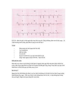 ECG124 : điện tim ghi từ một người đàn ông 70t bị suy tim. Ông ta không phàn nàn về đau ngực . Có
3 bất thường chính ở đây, phải điều trị ông ta như thế nào ?
Trả lời
- Nhịp xoang với một ngoại tâm thu thất
- Trục hướng trái
- QRS hơi rộng
- Q từ V2-V5
- Đoạn ST chênh lên ở các đạo trình thành trước
- Sóng T đảo ngược ở đạo trình AVL, T dẹt ở DI,V6
Diễn giải lâm sàng
Một nhồi máu thành trước không rõ thời gian là nguyên nhân gây nhồi máu bloc phân nhánh trái
trước, điều này nó giải thích trục lệch trái và phức bộ QRS giãn rộng. Sóng T thay đổi ở các đạo trình
thành bên có thể là kết quả của thiếu máu cơ tim .
Bạn làm gì ?
Ngoại tâm thu thất không cần điều trị và trục lệch trái không có chỉ định cho tạo nhịp.Trong trường
hợp không bị đau ngực , nhồi máu thành trước không được xem là mới , vì vậy không được dùng
tiêu sợi huyết. Ôngta cần được dùng ACE và lợi tiểu.
 