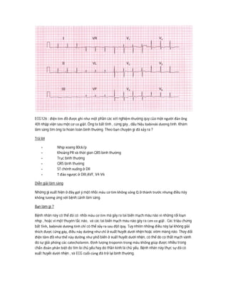 ECG126 : điện tim đồ được ghi như một phần các xét nghiệm thường quy của một người đàn ông
40t nhập viện sau một cơ co giật. Ông ta bất tỉnh , cứng gáy , dấu hiệu babinski dương tính. Khám
lâm sàng tim ông ta hoàn toàn bình thường. Theo bạn chuyện gì đã xảy ra ?
Trả lời
- Nhịp xoang 80ck/p
- Khoảng PR và thời gian QRS bình thường
- Trục bình thường
- QRS bình thường
- ST chênh xuống ở DII
- T đảo ngược ở DIII,AVF, V4-V6
Diễn giải lâm sàng
Những gì xuất hiện ở đây gợi ý một nhồi máu cơ tim không sóng Q ở thành trước nhưng điều này
không tương ứng với bệnh cảnh lâm sàng.
Bạn làm gì ?
Bệnh nhân này có thể đã có nhồi máu cơ tim mà gây ra tai biến mạch máu não vì những rối loạn
nhịp , hoặc vì một thuyên tắc não, và các tai biến mạch máu não gây ra cơn co giật . Các triệu chứng
bất tỉnh, babinski dương tính chỉ có thể xảy ra sau đột quỵ. Tuy nhiên những điều này lại không giải
thích được cứng gáy, điều này dường như chỉ ở xuất huyết dưới nhện hoặc viêm màng não. Thay đổi
điện tâm đồ như thế này dường như phổ biến ở xuất huyết dưới nhện, có thể do co thắt mạch vành
do sự giải phóng các catecholamin. Định lượng troponin trong máu không giúp được nhiều trong
chẩn đoán phân biệt do tim là chủ yếu hay do thần kinh là chủ yếu. Bệnh nhân này thực sự đã có
xuất huyết dưới nhện , và ECG cuối cùng đã trở lại bình thường.
 