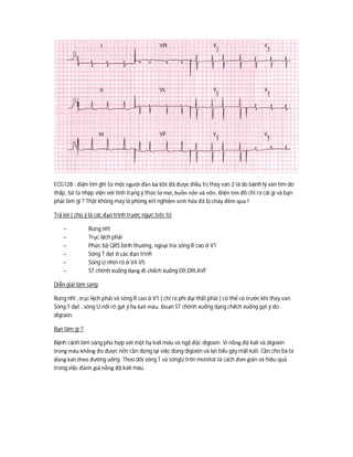ECG128 : điện tim ghi từ một người đàn bà 65t đã được điều trị thay van 2 lá do bệnh lý van tim do
thấp, bà ta nhập viện với tình trạng ý thức lơ mơ, buồn nôn và nôn. Điện tim đồ chỉ ra cái gì và bạn
phải làm gì ? Thật không may là phòng xét nghiệm sinh hóa đã bị cháy đêm qua !
Trả lời ( chú ý là các đạo trình trước ngực tets ½)
- Rung nhĩ
- Trục lệch phải
- Phức bộ QRS bình thường, ngoại trừ sóng R cao ở V1
- Sóng T dẹt ở các đạo trình
- Sóng U nhìn rõ ở V4-V5
- ST chênh xuống dạng đi chếch xuống DII,DIII,AVF
Diễn giải lâm sàng
Rung nhĩ , trục lệch phải và sóng R cao ở V1 ( chỉ ra phì đại thất phải ) có thể có trước khi thay van.
Sóng T dẹt , sóng U nổi rõ gợi ý hạ kali máu. Đoạn ST chênh xuống dạng chếch xuống gợi ý do
digoxin.
Bạn làm gì ?
Bệnh cảnh lâm sàng phù hợp với một hạ kali máu và ngộ độc digoxin. Vì nồng độ kali và digoxin
trong máu không đo được nên cần dừng lại việc dùng digoxin và lợi tiểu gây mất kali. Cần cho bà ta
dùng kali theo đường uống. Theo dõi sóng T và sóngU trên monitor là cách đơn giản và hiệu quả
trong việc đánh giá nồng độ kali máu.
 