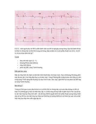 ECG12 : một người phụ nữ 90t tự đến bệnh viện sau khi bị ngã gãy xương hông. Qua hỏi bệnh thì bà
ta khai có chóng mặt và khó thở trong vài tháng. Đây là điện tim trước phẫu thuật của cô ta . nó chỉ
ra cái gì và bạn phải làm gì ?
Trả lời
- bloc nhĩ thất cấp II (2 : 1 )
- khoảng PR kéo dài (440ms)
- nhịp thất 40ck/p
- phức bộ QRS ,sóng T bình thường
Diễn giải lâm sàng
Mặc dù nhịp thất rất chậm có thể tiến triển thành bloc tim hoàn toàn, thực tế khoảng PR không đổi (
mặc dù kéo dài ) cho thấy đây thực sự là bloc cấp 2. Sóng P không dẫn ở đây là khó nhìn thấy,nó nằm
trong sóng T hình dạng bất thường của đạo trinh trước. bloc cấp 2 giải thích tại sao phức bộ QRS hẹp
và sóng T bình thường .
Bạn làm gi ?
Trong vài thời gian trước đây thì bà ta có cái khó thở và chóng mặt, và trước đây không có tiền sử
hoặc ECG không gợi ý một cái nhồi máu cấp, ít có khả năng rối loạn dẫn truyền này là mới. Do đó bà
ta cần một máy tạo nhịp vĩnh viễn : vấn đề duy nhất là quyết định nên phẫu thuật xương hông khẩn
cấp với sự hỗ trợ cửa một máy tạo nhịp tạm thời hay lý tưởng nhất bà ta sẽ hoãn lại cuộc mổ và đặt
một máy tạo nhịp vĩnh viễn ngay lập tức .
 