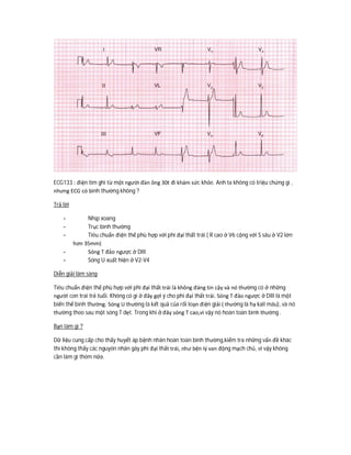 ECG133 : điện tim ghi từ một người đàn ông 30t đi khám sức khỏe. Anh ta không có triệu chứng gì ,
nhưng ECG có bình thường không ?
Trả lời
- Nhịp xoang
- Trục bình thường
- Tiêu chuẩn điện thế phù hợp với phì đại thất trái ( R cao ở V6 cộng với S sâu ở V2 lớn
hơn 35mm)
- Sóng T đảo ngược ở DIII
- Sóng U xuất hiện ở V2-V4
Diễn giải lâm sàng
Tiêu chuẩn điện thế phù hợp với phì đại thất trái là không đáng tin cậy và nó thường có ở những
người con trai trẻ tuổi. Không có gì ở đây gợi ý cho phì đại thất trái. Sóng T đảo ngược ở DIII là một
biến thể bình thường. Sóng U thường là kết quả của rối loạn điện giải ( thường là hạ kali máu), và nó
thường theo sau một sóng T dẹt. Trong khi ở đây sóng T cao,vì vậy nó hoàn toàn bình thường .
Bạn làm gì ?
Dữ liệu cung cấp cho thấy huyết áp bệnh nhân hoàn toàn bình thường,kiểm tra những vấn đề khác
thì không thấy các nguyên nhân gây phì đại thất trái, như bện lý van động mạch chủ, vì vậy không
cần làm gì thêm nữa.
 