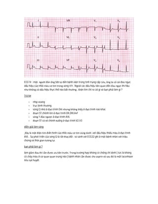 ECG14 : một người đàn ông 50t tự đến bệnh viện trong tình trạng cấp cứu, ông ta có cái đau ngực
dấu hiệu của nhồi máu cơ tim trong vòng 4 h . Ngoài các dấu hiệu liên quan đến đau ngực thì hầu
như không có dấu hiệu thực thể nào bất thường . Điện tim chỉ ra cái gì và bạn phải làm gì ?
Trả lời
- nhịp xoang
- trục bình thường
- sóng Q nhỏ ở đạo trình DIII nhưng không thấy ở đạo trình nào khác
- đoạn ST chênh lên ở đạo trình DII,DIII,Avf
- sóng T đảo ngược ở đạo trình AVL
- đoạn ST có vẻ chênh xuống ở đạo trình V2,V3
diễn giải lâm sàng
đây là một điện tim điển hình của nhồi máu cơ tim vùng dưới ,với dấu hiệu thiếu máu ở đạo trình
AVL . Sự phát triển của sóng Q là rất thay đổi : so sánh với ECG32 ghi ở một bệnh nhân với triệu
chứng và thời gian tương tự.
bạn phải làm gì ?
làm giảm đau thì cần đươc ưu tiên trước. Trong trường hợp không có chống chỉ định ( tức là không
có chảy máu ở cơ quan quan trọng nào ) bệnh nhân cần được cho asprin và sau đó là một tacsnhaan
tiêu sợi huyết.
 