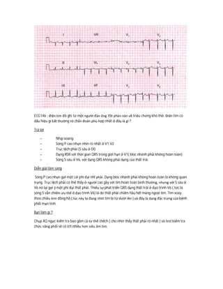 ECG146 : điện tim đồ ghi từ một người đàn ông 70t phàn nàn về triệu chứng khó thở. Điện tim có
dấu hiệu gì bất thường và chẩn đoán phù hợp nhất ở đây là gì ?
Trả lời
- Nhịp xoang
- Sóng P cao nhọn nhìn rõ nhất ở V1,V2
- Trục lệch phải (S sâu ở DI)
- Dạng RSR với thời gian QRS trong giới hạn ở V1( bloc nhánh phải không hoàn toàn)
- Sóng S sâu ở V6, với dạng QRS không phải dạng của thất trái.
Diễn giải lâm sàng
Sóng P cao nhọn gợi một cái phì đại nhĩ phải. Dạng bloc nhánh phải không hoàn toàn là không quan
trọng. Trục lệch phải có thể thấy ở người cao gầy với tim hoàn toàn bình thường, nhưng với S sâu ở
V6 nó lại gợi ý một phì đại thất phải. Thiếu sự phát triển QRS dạng thất trái ở đạo trình V6 ( tức là
sóng S vẫn chiếm ưu thế ở đạo trình V6) là do thất phải chiếm hầu hết màng ngoài tim. Tim xoay
theo chiều kim đồng hồ ( lúc này ta đang nhìn tim là từ dưới lên ) và đây là dạng đặc trưng của bệnh
phổi mạn tính.
Bạn làm gì ?
Chụp XQ ngực kiểm tra bao gồm cả tư thế chếch ( cho nhìn thấy thất phải rõ nhất ) và test kiểm tra
chức năng phổi sẽ có ích nhiều hơn siêu âm tim.
 
