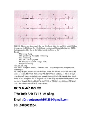 ECG150: điện tim ghi từ một người đàn ông 40t , ông ta nhập viện sau khi bị ngất ở khi đang
ở trong siêu thị. Khi ông ta đến viện thì ông ta bình thường,không có dấu hiệu thực thể bất
thường được tìm thấy. Bạn sẽ cho là điện tim này bình thường chứ ?
Trả lời
- Nhịp xoang 70ck/p
- Thời gian khoảng PR và QRS bình thường
- Trục bình thường
- QRS ở V1-V2 có dạng RSR
- ST chênh lên và đi chếch xuống ở V1,V2
- Sóng T bình thường
Diễn giải lâm sàng
Điện tim đồ không bình thường. Xuất hiện ở V1,V2 là đặc trưng của hội chứng brugada.
Bạn làm gì ?
Hội chứng brugada liên quan với bất thường di truyền làm biến đổi vận chuyển natri trong
cơ tim và nó dẫn đến nhanh thất và rung thất. Bệnh nhân bị ngất cũng có thể do rối loạn
nhịp những rối loạn nhịp này.Hội chứng brugada thường có tính chất gia đình. Điện tim đồ
không phải là không thay đổi, và ngày hôm sau sau khi nhập viện điện tim đồ hoàn toàn bình
thường.Sự thay đổi điện tim đồ và nhịp nhanh thất có thể gây ra bởi các thuốc chống loạn
nhịp. Cách điều trị duy nhất là cấy máy phá rung.
Đi thì sẽ đến thôi !!!!
Trần Tuấn Anh BV 17- Đà Nẵng
Email : Drtrantuananh301286@gmail.com
Sđt :0985002204.
 