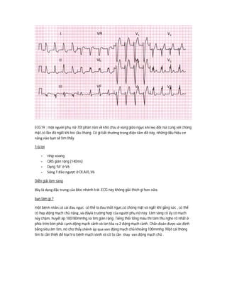 ECG19 : một người phụ nữ 70t phàn nàn về khó chịu ở vùng giữa ngực khi leo đồi núi cùng với chóng
mặt,có lần đã ngất khi leo cầu thang. Có gì bất thường trong điện tâm đồ này, những dấu hiệu cơ
năng nào bạn sẽ tìm thấy.
Trả lời
- nhịp xoang
- QRS giãn rộng (140ms)
- Dạng ‘M’ ở V6
- Sóng T đảo ngược ở DI,AVL,V6
Diễn giải lâm sàng
đây là dạng đặc trưng của bloc nhánh trái .ECG này không giải thích gì hơn nữa.
bạn làm gì ?
một bệnh nhân có cái đau ngực có thể là đau thắt ngực,có chóng mặt và ngất khi gắng sức , có thể
có hẹp động mạch chủ nặng ,và đâylà trường hợp của người phụ nữ này. Lâm sàng cô ấy có mạch
nảy chậm, huyết áp 100/80mmhg,và tim giãn rộng. Tiếng thổi tống máu thì tâm thu nghe rõ nhất ở
phía trên bên phải cạnh động mạch cảnh và lan tỏa ra 2 động mạch cảnh. Chẩn đoán được xác định
bằng siêu âm tim, nó cho thấy chênh áp qua van động mạch chủ khoảng 100mmhg. Một cái thông
tim là cần thiết để loại trừ bệnh mạch vành và cô ta cần thay van động mạch chủ .
 