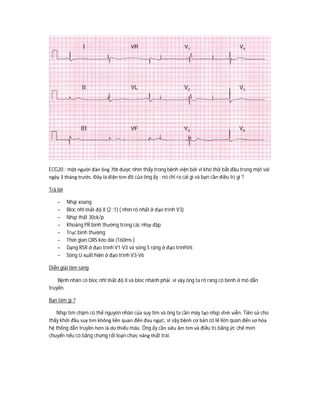 ECG20 : một người đàn ông 70t được nhìn thấy trong bệnh viện bởi vì khó thở bắt đầu trong một vài
ngày 3 tháng trước. Đây là điện tim đồ của ông ấy : nó chỉ ra cái gì và bạn cần điều trị gì ?
Trả lời
- Nhịp xoang
- Bloc nhĩ thất độ II (2 :1) ( nhìn rõ nhất ở đạo trình V3)
- Nhịp thất 30ck/p
- Khoảng PR bình thường trong các nhịp đập
- Trục bình thường
- Thời gian QRS kéo dài (160ms )
- Dạng RSR ở đạo trình V1-V3 và sóng S rộng ở đạo trìnhV6
- Sóng U xuất hiện ở đạo trình V3-V6
Diễn giải lâm sàng
Bệnh nhân có bloc nhĩ thất độ II và bloc nhánh phải. vì vậy ông ta rõ ràng có bênh ở mô dẫn
truyền.
Bạn làm gì ?
Nhịp tim chậm có thể nguyên nhân của suy tim và ông ta cần máy tạo nhịp vĩnh viễn. Tiền sử cho
thấy khởi đầu suy tim không liên quan đến đau ngực, vì vậy bệnh cơ bản có lẽ liên quan đến sơ hóa
hệ thống dẫn truyền hơn là do thiếu máu. Ông ấy cần siêu âm tim và điều trị bằng ức chế men
chuyển nếu có bằng chứng rối loạn chức năng thất trái.
 