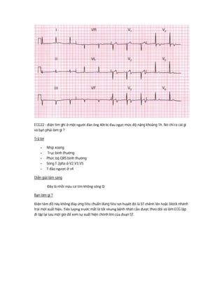ECG22 : điện tim ghi ở một người đàn ông 40t bị đau ngực mức độ nặng khoảng 1h. Nó chỉ ra cái gì
và bạn phải làm gì ?
Trả lời
- Nhịp xoang
- Trục bình thường
- Phức bộ QRS bình thường
- Sóng T 2pha ở V2,V3,V5
- T đảo ngược ở v4
Diễn giải lâm sàng
Đây là nhồi máu cơ tim không sóng Q
Bạn làm gì ?
Điện tâm đồ này không đáp ứng tiêu chuẩn dùng tiêu sợi huyêt đó là ST chênh lên hoặc block nhánh
trái mới xuất hiện. Tiên lượng trước mắt là tốt nhưng bệnh nhân cần được theo dõi và làm ECG lặp
đi lặp lại sau một giờ để xem sự xuất hiện chênh lên của đoạn ST.
 