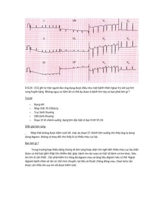 ECG24 : ECG ghi từ một người đàn ông đang được điều như một bệnh nhân ngoại trú với suy tim
sung huyết nặng. Những nguy cơ tiềm ẩn có thể dự đoán ở bệnh tim này và bạn phải làm gì ?
Trả lời
- Rung nhĩ
- Nhịp thất 70-250ck/p
- Trục bình thường
- QRS bình thường
- Doạn ST đi chênh xuống dạng lõm đặc biệt ở đạo trình V5,V6
Diễn giải lâm sàng
Nhịp thất không được kiểm soát tốt ,mặc dù đoạn ST chênh lõm xuống cho thấy ông ta đang
dùng digoxin. Không có thay đổi cho thấy là có thiếu máu cục bộ .
Bạn làm gì ?
Trong trường hợp thiếu bằng chứng về lâm sàng hoặc điện tim nghĩ đến thiếu máu cục bộ,chẩn
đoán có thể bao gồm thấp tim,nhiễm độc giáp ,bệnh tim do rượu và một số bệnh cơ tim khác. Siêu
âm tim là cần thiết . Cần phải kiểm tra nồng độ digoxin máu và tăng liều digoxin nếu có thể. Ngoài
digoxin bệnh nhân sẽ cần ức chế men chuyển, lợi tiểu và thuốc chống đông máu. Chẹn beta cần
được cân nhắc khi suy tim đã được kiếm soát.
 