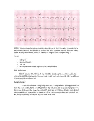 ECG28 : điện tâm đồ ghi từ một người đàn ông 40t phàn nàn về khó thở tăng lên khi leo cầu thang.
Ông ta không cảm thấy tim rất nhanh và không có đau ngực . Ngoài việc với nhịp tim nhanh không
có bất thường tim mạch khác, nhưng da anh ta có vẻ vàng và lách to . bạn phải làm gì ?
Trả lời
- Cuồng nhĩ
- Nhịp thất 140ck/p
- Trục trái
- Phức bộ QRS bình thường ,ngoại trừ sóng S ở đạo trìnhV6
Diễn giải lâm sàng
ECG chỉ ra cuồng nhĩ với bloc 2 :1. Trục trái có thể là do bloc phân nhánh trái trước , tuy
nhiên phức bộ QRS có thời gian bình thường vì vậy ý nghĩa của trục là chưa chắc chắn. Sóng S ở đạo
trình V6 gợi ý bệnh phổi mạn tính.
Bạn phải làm gì ?
Quy cho một bệnh nhân không có suy tim là một ý tưởng tốt để xác định nguyên nhân của
loạn nhịp trước khi điều trị nó . Sự kết hợp rối loạn nhịp nhĩ ,và da ,lách to gợi ý chứng nghiện rượu.
Bệnh nhân cần thuốc chống đông nhưng chỉ số IRN của ông ta có thể đã cao. Siêu âm tim là cần thiết
để đánh giá lại chức năng thất trái và digoxin có thể cần thiết trong nỗ lực kiểm soát nhịp thất. Sau
khi chống chuyển nhịp với sốc điện hoặc flecainide là cần thiết.
 