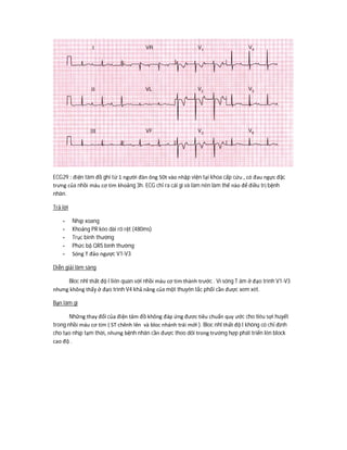 ECG29 : điện tâm đồ ghi từ 1 người đàn ông 50t vào nhập viện tại khoa cấp cứu , có đau ngực đặc
trưng của nhồi máu cơ tim khoảng 3h. ECG chỉ ra cái gì và làm nên làm thế nào để điều trị bệnh
nhân.
Trả lời
- Nhịp xoang
- Khoảng PR kéo dài rõ rệt (480ms)
- Trục bình thường
- Phức bộ QRS bình thường
- Sóng T đảo ngược V1-V3
Diễn giải lâm sàng
Bloc nhĩ thất độ I liên quan với nhồi máu cơ tim thành trước . Vì sóng T âm ở đạo trình V1-V3
nhưng không thấy ở đạo trình V4 khả năng của một thuyên tắc phổi cần được xem xét.
Bạn làm gì
Những thay đổi của điện tâm đồ không đáp ứng đươc tiêu chuẩn quy ước cho tiêu sợi huyết
trong nhồi máu cơ tim ( ST chênh lên và bloc nhánh trái mới ). Bloc nhĩ thất độ I không có chỉ định
cho tạo nhịp tạm thời, nhưng bệnh nhân cần được theo dõi trong trường hợp phát triển lên block
cao độ .
 